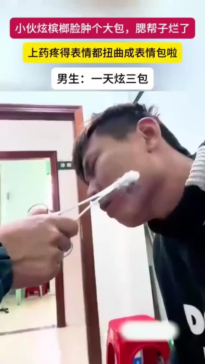 健康常识:小伙吃槟榔脸上长了一个大包,腮帮子溃烂上药疼出表情包