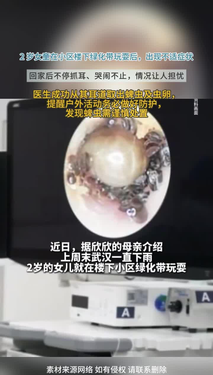 家长必看!2 岁女童绿化带玩耍中招,耳道藏蜱虫及虫卵,蜱虫处理有讲究