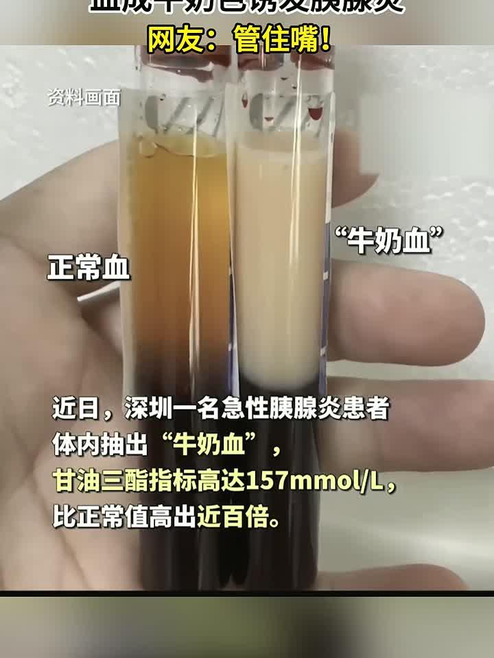 益生:长期喝奶茶+啤酒配烧烤,血成牛奶色诱发胰腺炎,网友:管