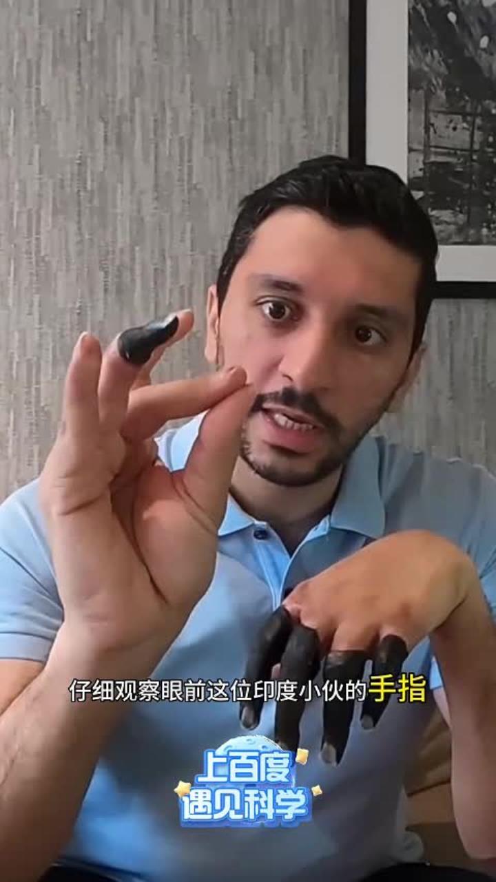 印度小伙攀登珠峰，手指被三级冻伤，到底有多可怕？