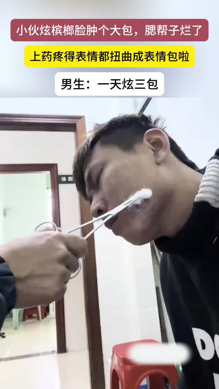 小伙吃槟榔脸上长了一个大包,腮帮子溃烂上药疼出表情包