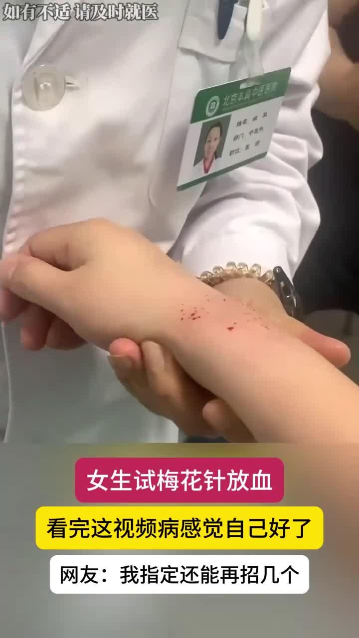 梅花针放血疗法:亲身体验效果揭秘