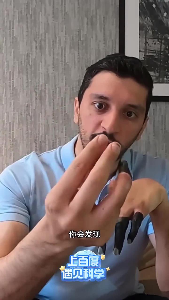 印度小伙攀登珠峰，手指被三级冻伤，到底有多可怕？