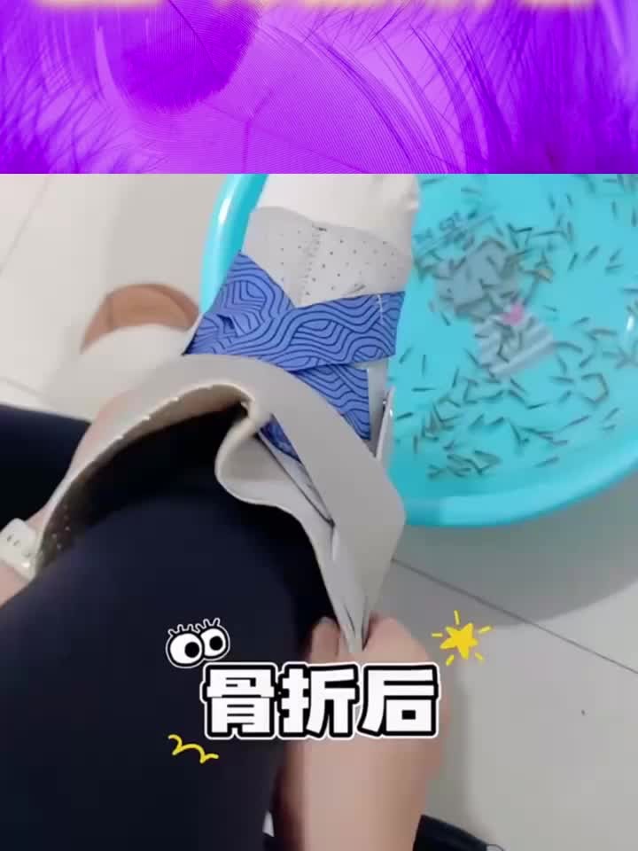 超级实用的健康知识，女子拆石膏泡脚做鱼疗 结果脚一下水 鱼就不
