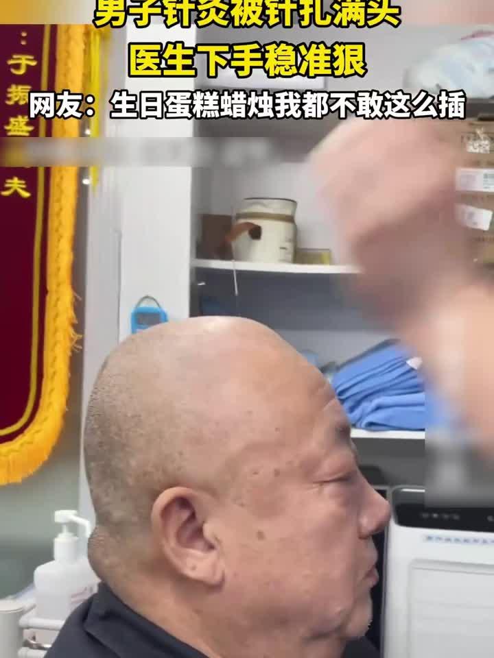男子针灸被针扎满头,医生下手稳准狠,网友:生日蛋糕蜡烛我都不