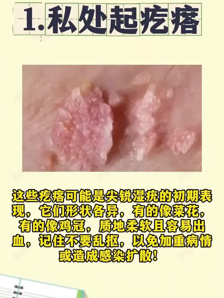 艾滋病的这些信号,你注意到了吗?