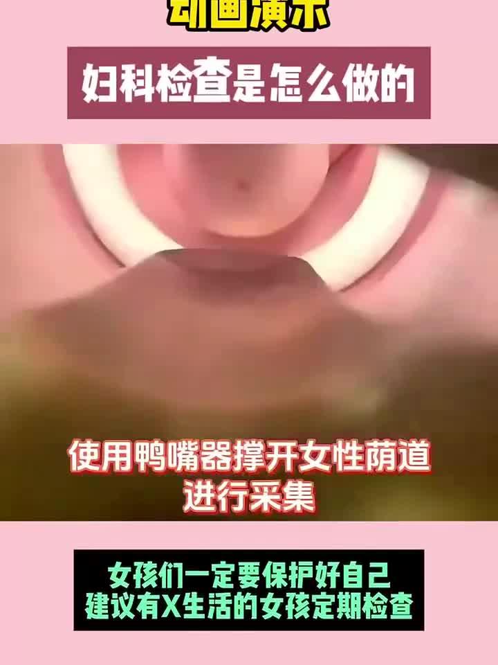 妇科检查 一镜到底