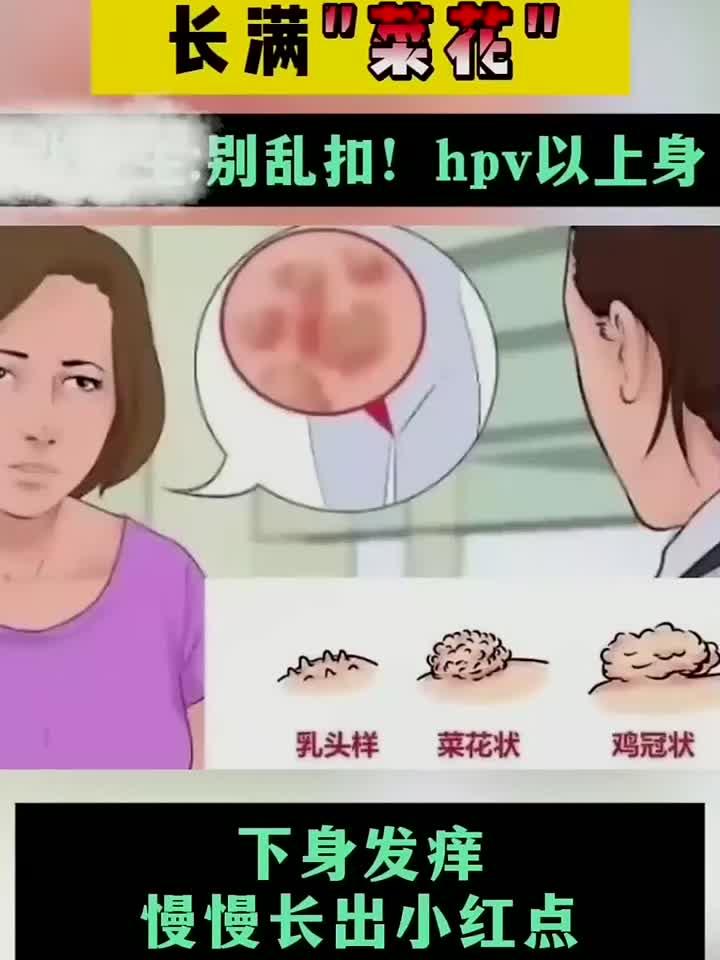 菜花状疣体实录:症状表现与处理要点