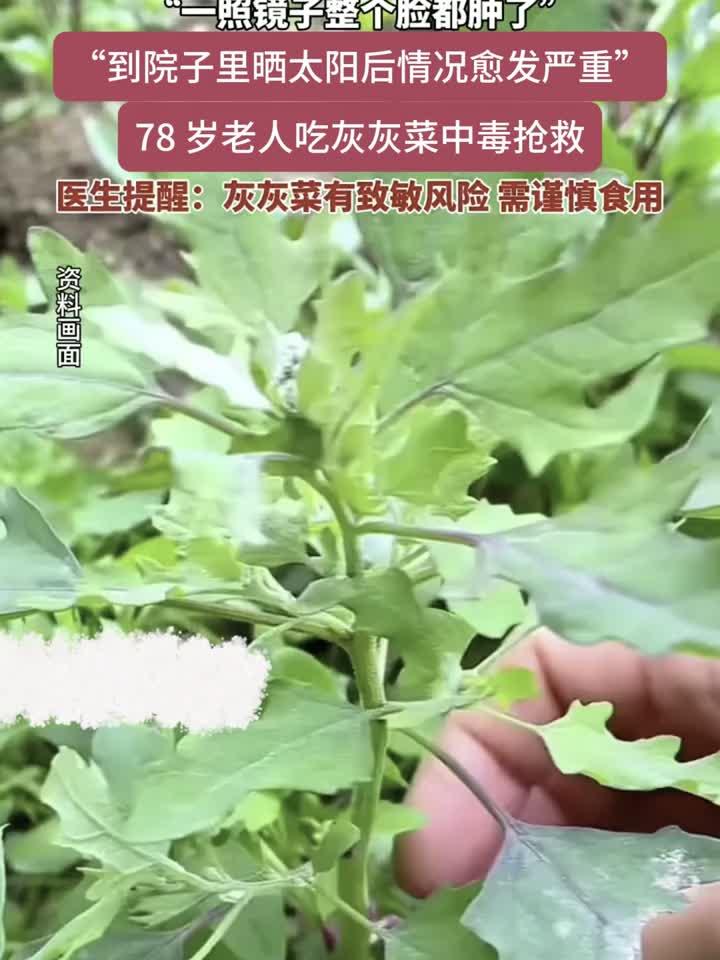 78岁老人吃灰灰菜中毒进医院抢救，医生建议谨慎食用灰灰菜
