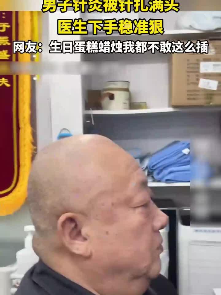 男子针灸被针扎满头，医生下手稳准狠，网友：生日蛋糕蜡烛我都不