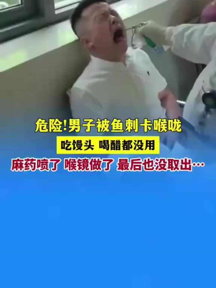 危险！男子被鱼刺卡喉咙，吃馒头，喝醋都没用，麻药喷了，喉镜做