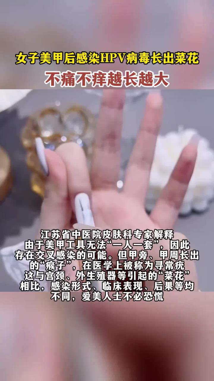 女子美甲后感染HPV病毒长出菜花,不痛不痒越长越大