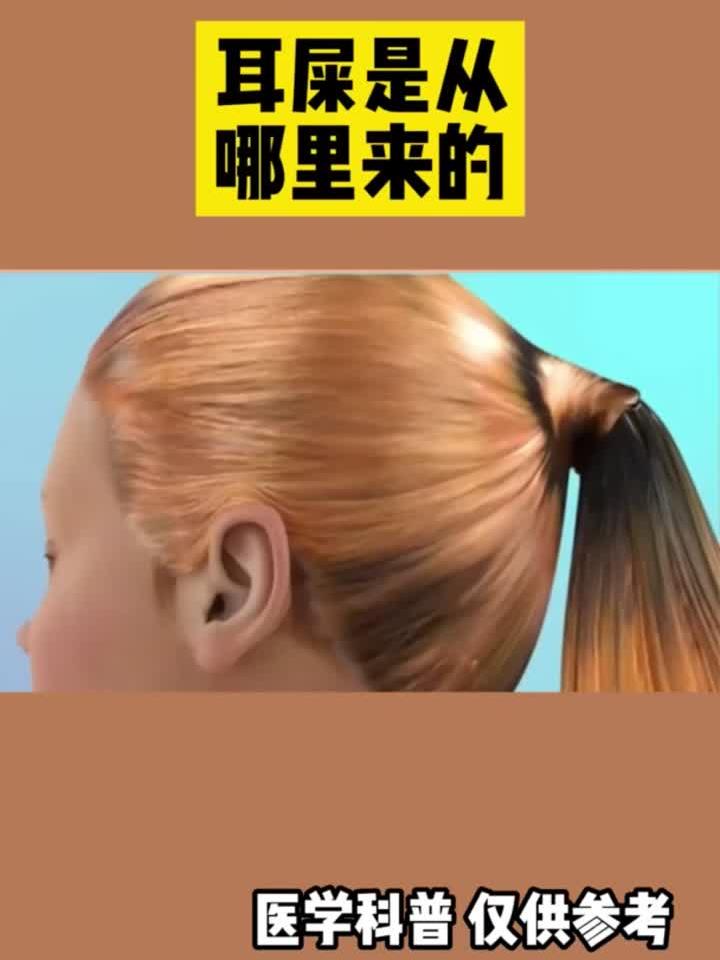 耳屎竟是这样产生的!揭秘耳垢来源全过程