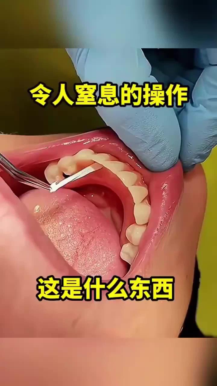 牙里面有异物，这是什么东西！