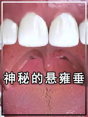 神秘的悬雍垂