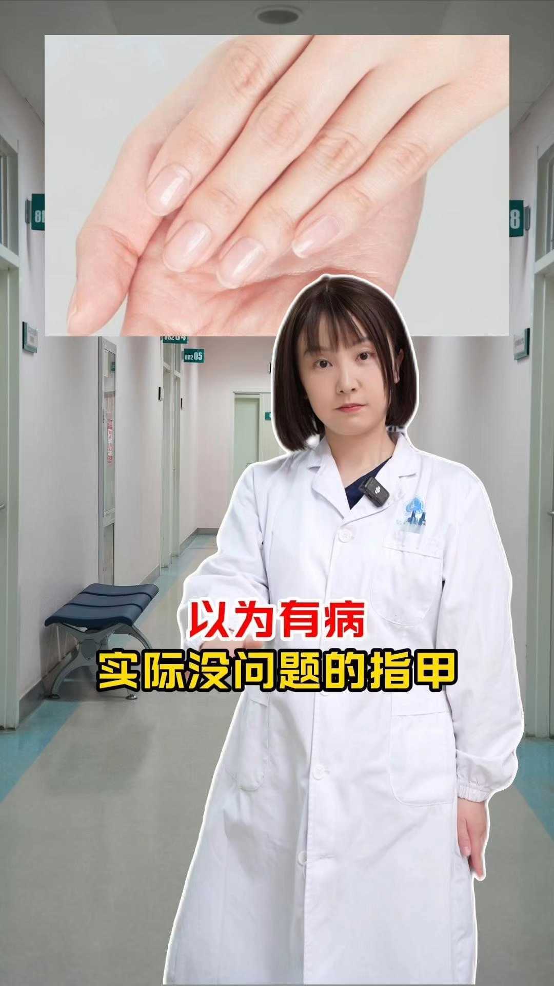 以为有病,实际没问题的指甲
