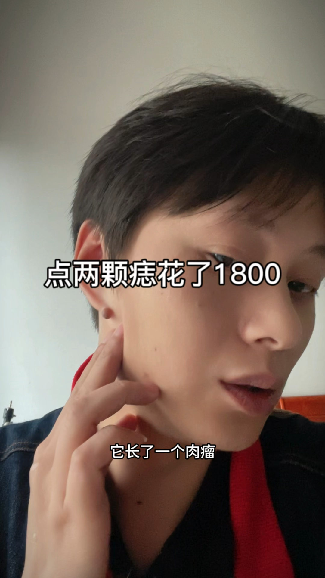 关于我去医院点两颗痣，花了1800这件事，自卑感而付出的代价