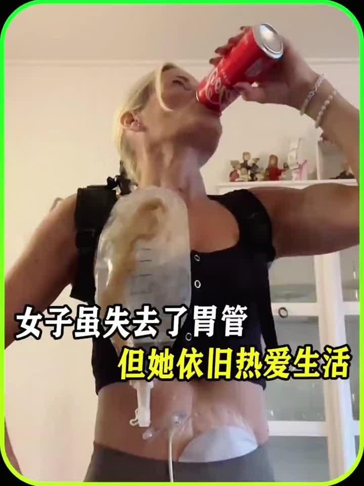 女子虽失去了胃管，但她依旧热爱生活，值得一看闻趣事