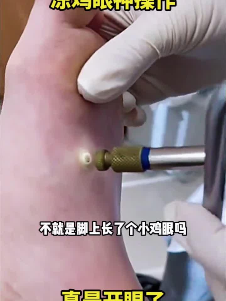 冻鸡眼神操作，真是开眼了