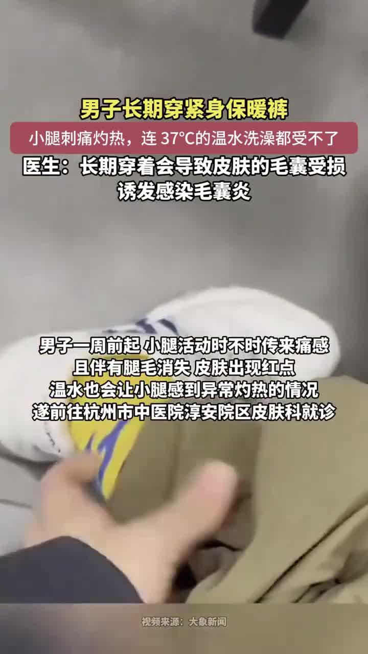 健康小锦囊:紧身裤伤小腿健康