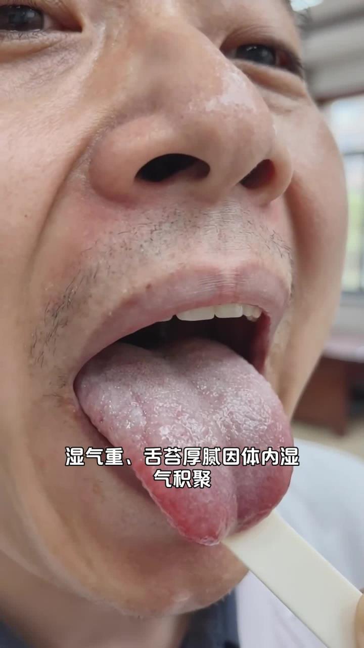 湿气重舌苔厚腻，茯苓薏米粥有用吗？