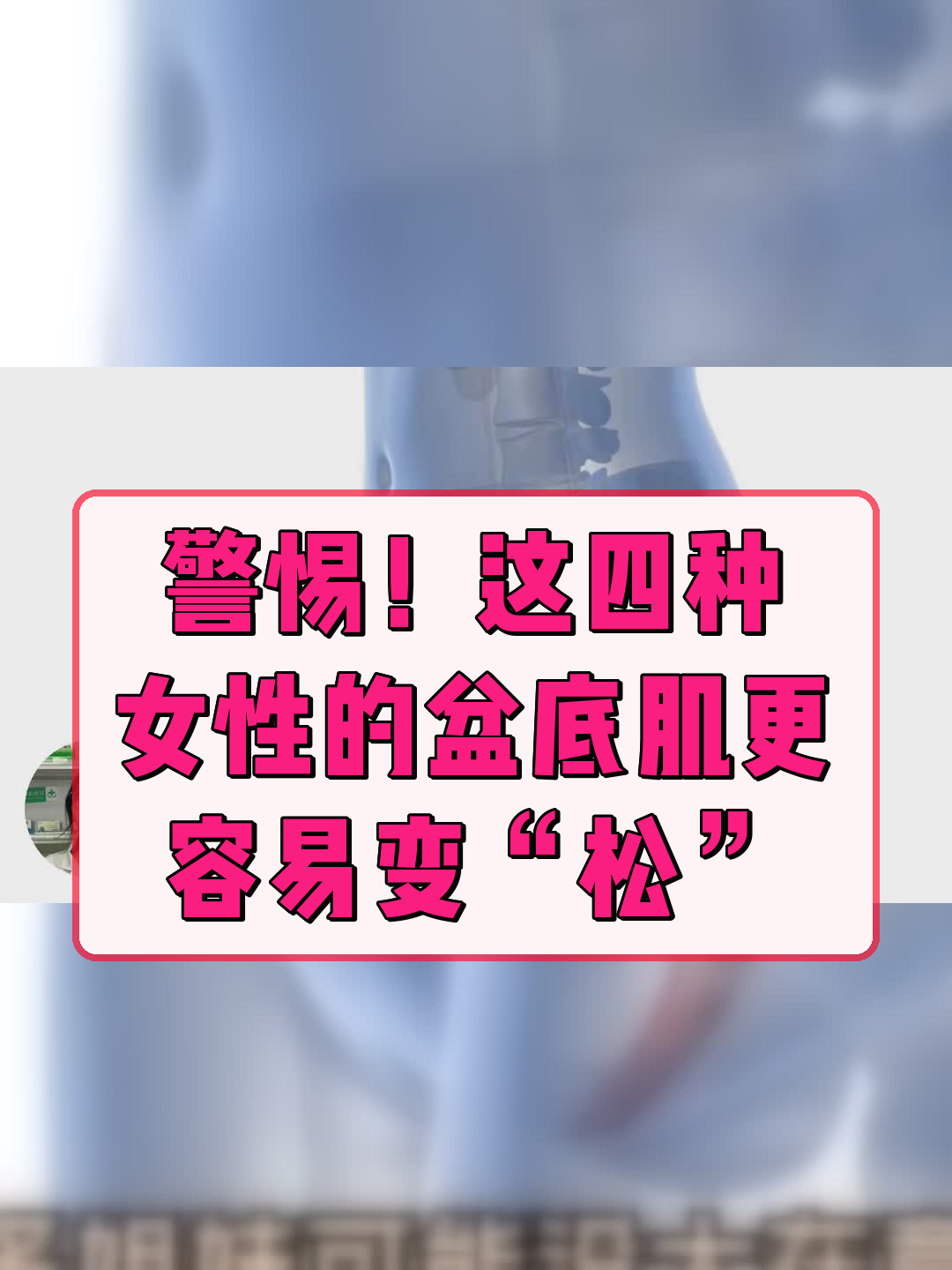 警惕!这四种女性的盆底肌更容易变“松”