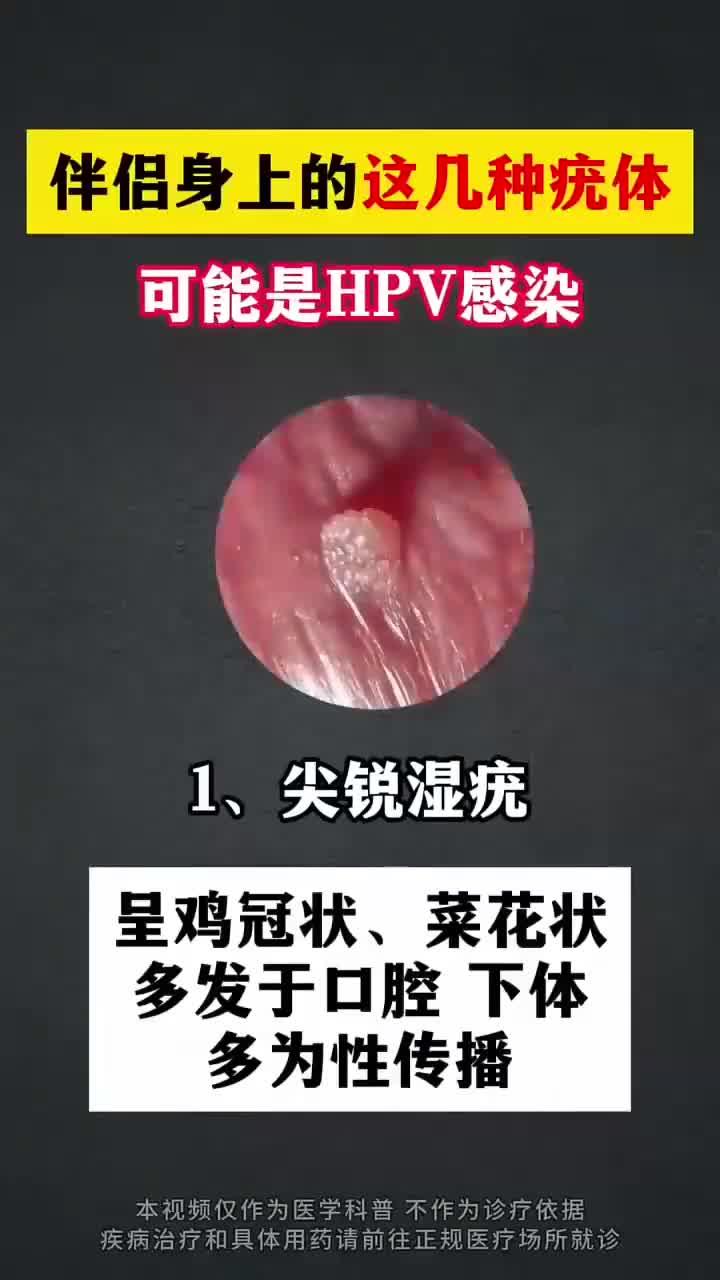 伴侣出现疣体,警惕HPV感染风险