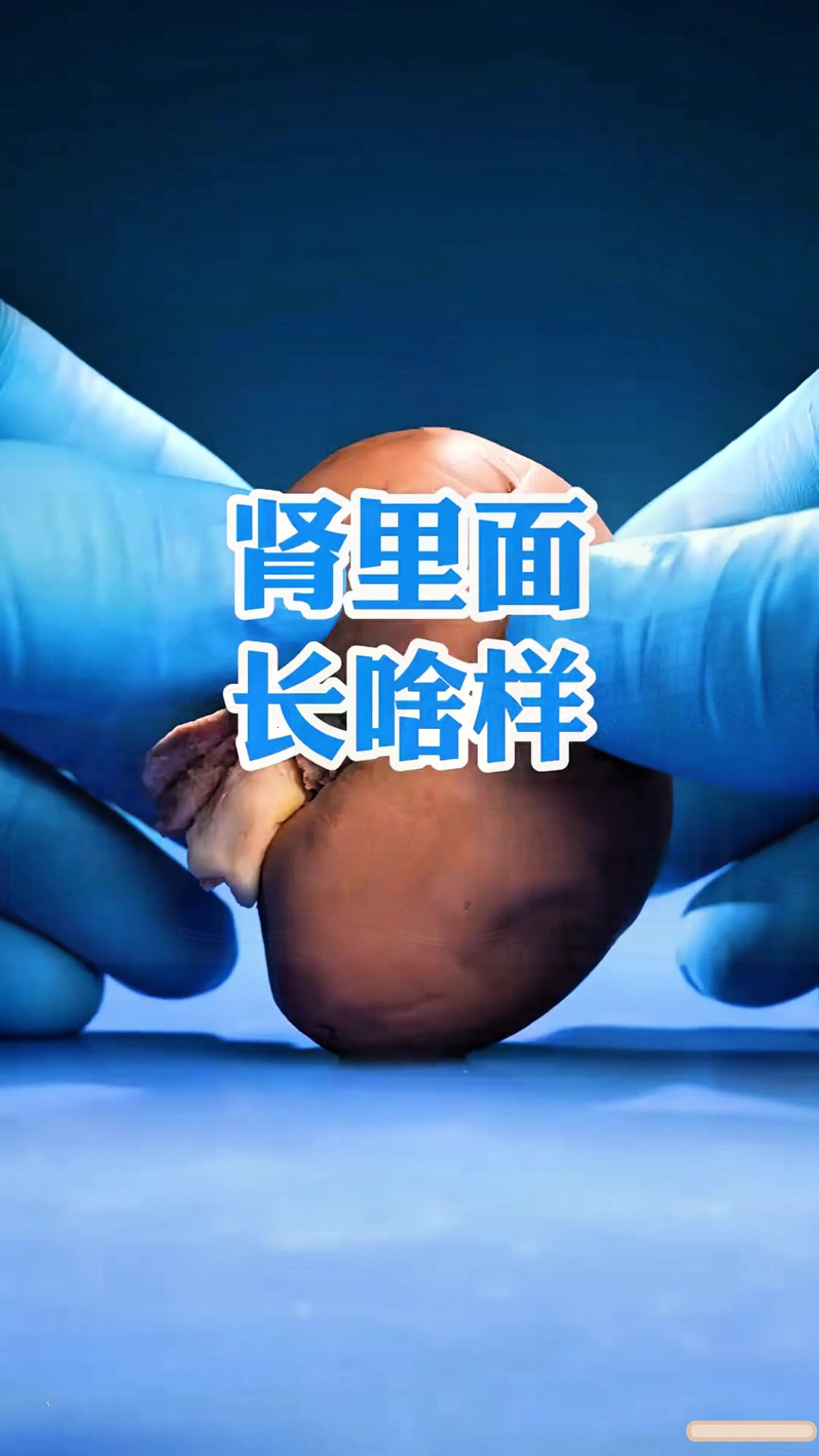 肾里面长啥样