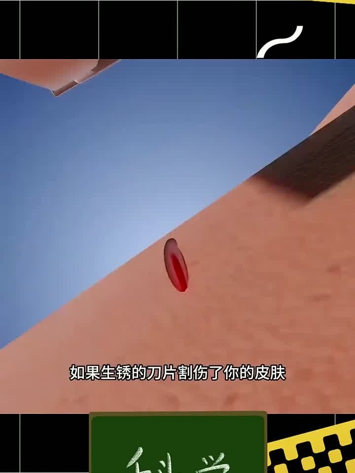 有趣的冷知识,假如被生锈的刀片划伤,那么可能会感染食肉细菌
