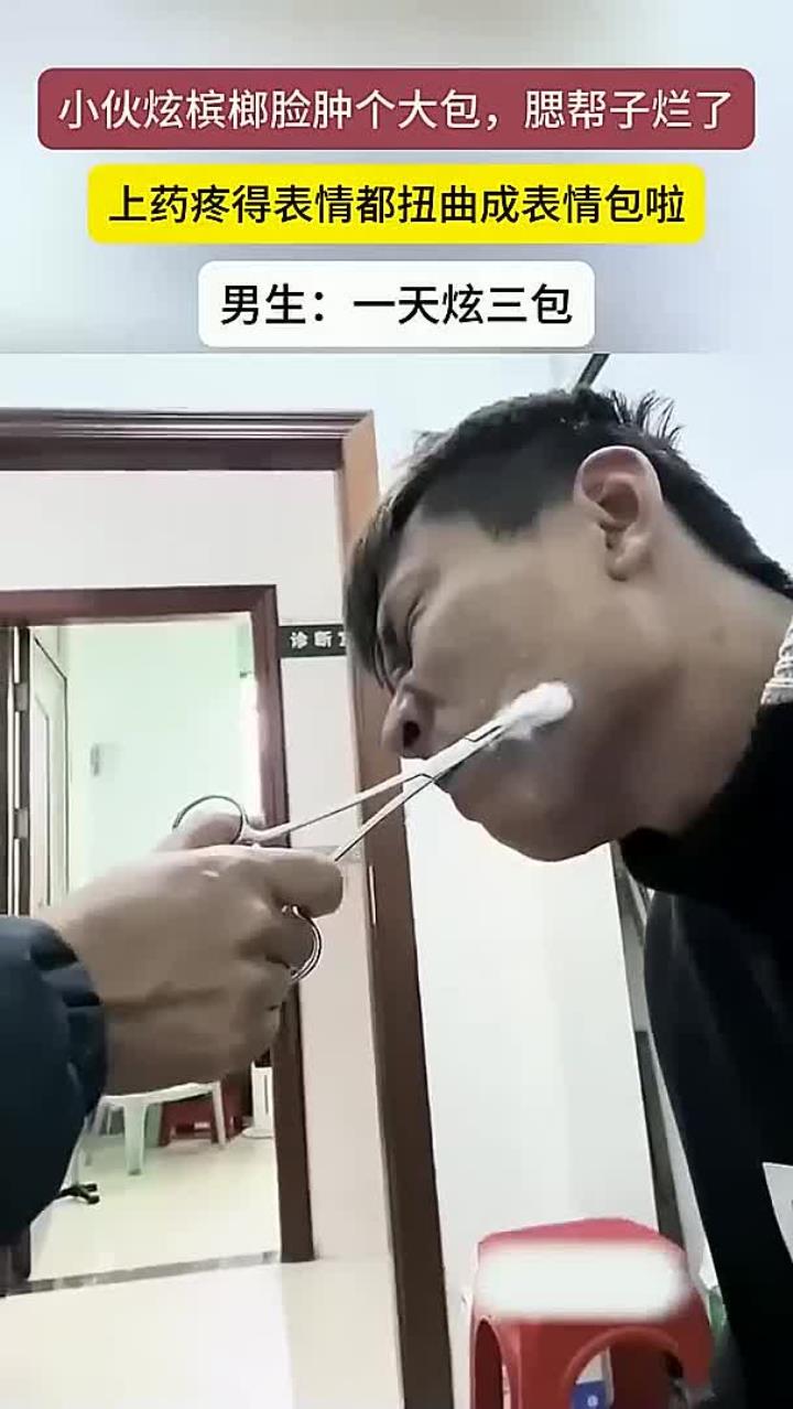 小伙吃槟榔脸上长了一个大包,腮帮子溃烂上药疼出表情包