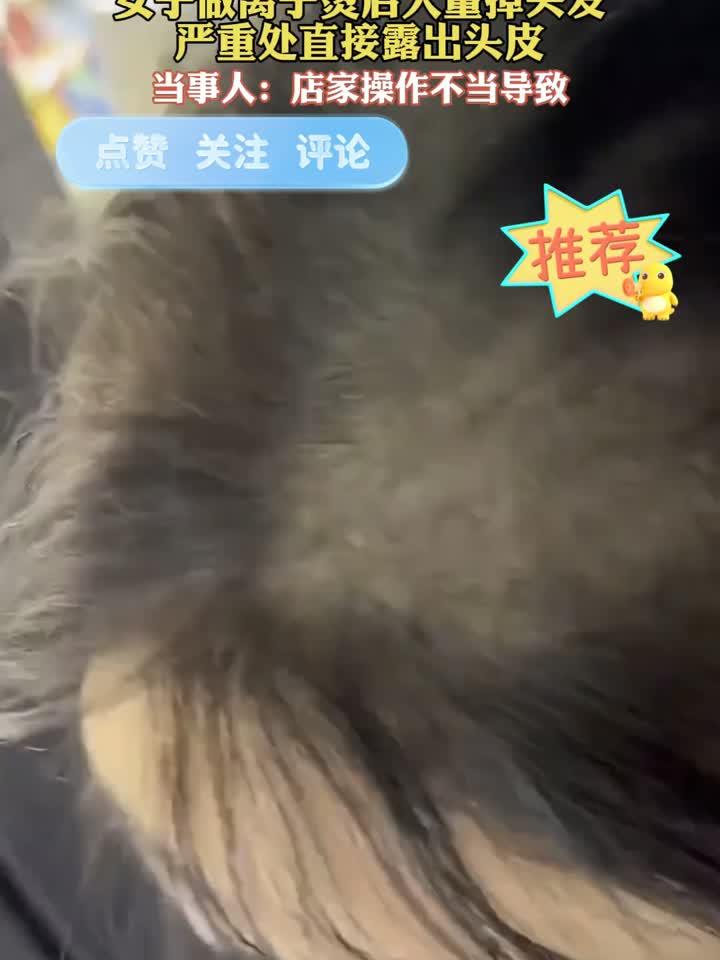 女子做离子烫后大量掉头发,严重处直接露出头皮