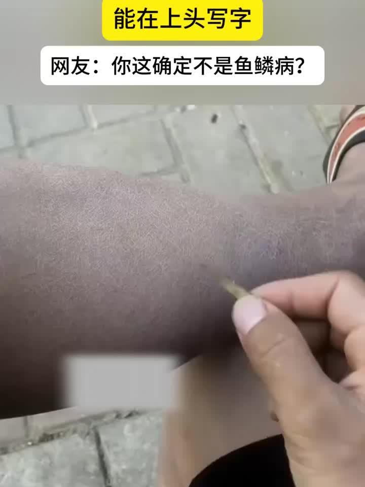 健康养生知识讲堂:男子的皮肤有点干巴,甚至能在上面写字