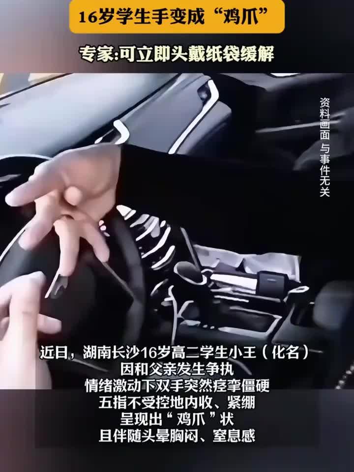 与父亲争执后,16岁少年双手突发“鸡爪状”痉挛