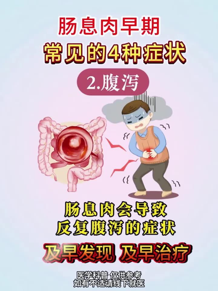 肠息肉早期常见的4种症状