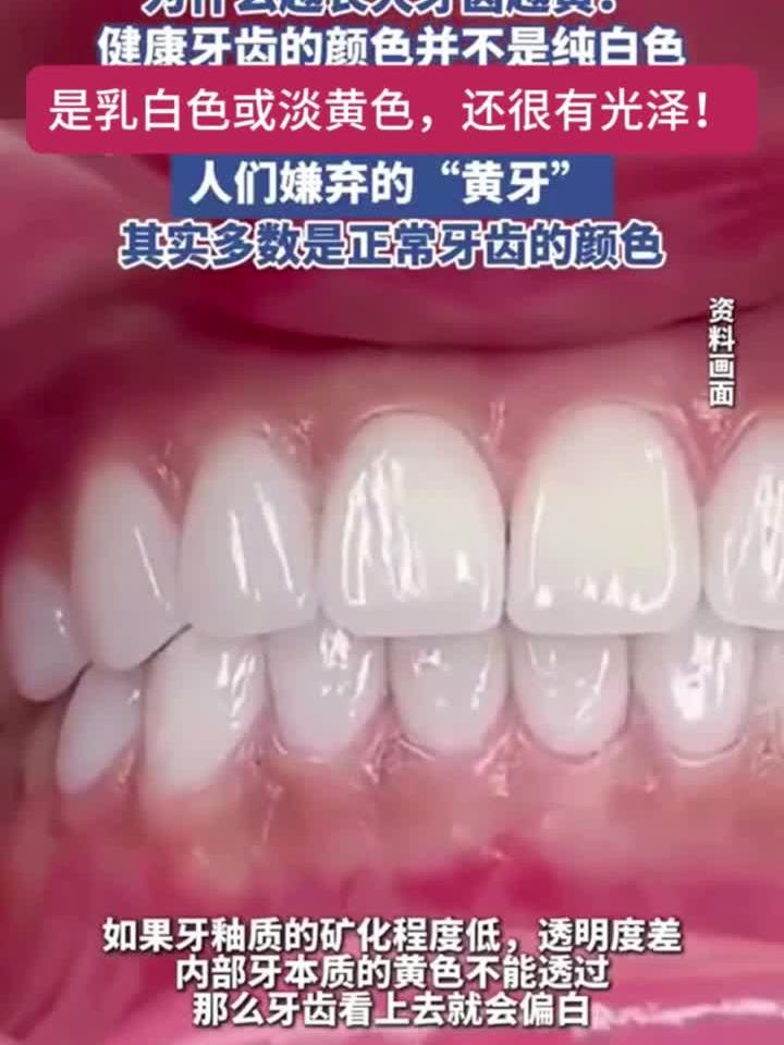健康牙齿的颜色并不是纯白色