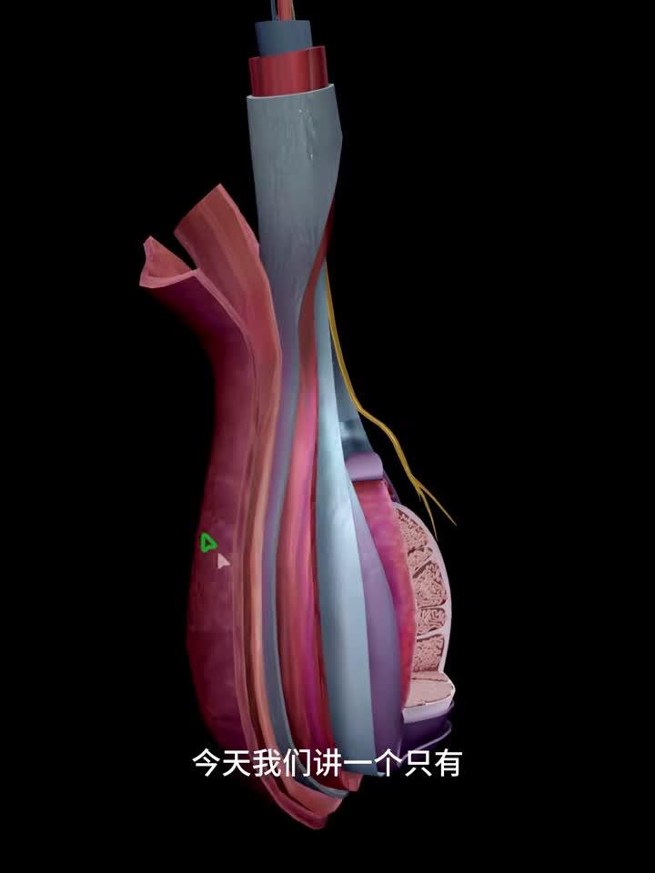 睾丸鞘膜积液与精索静脉曲张是怎么回事 睾丸鞘膜积液与精索静脉
