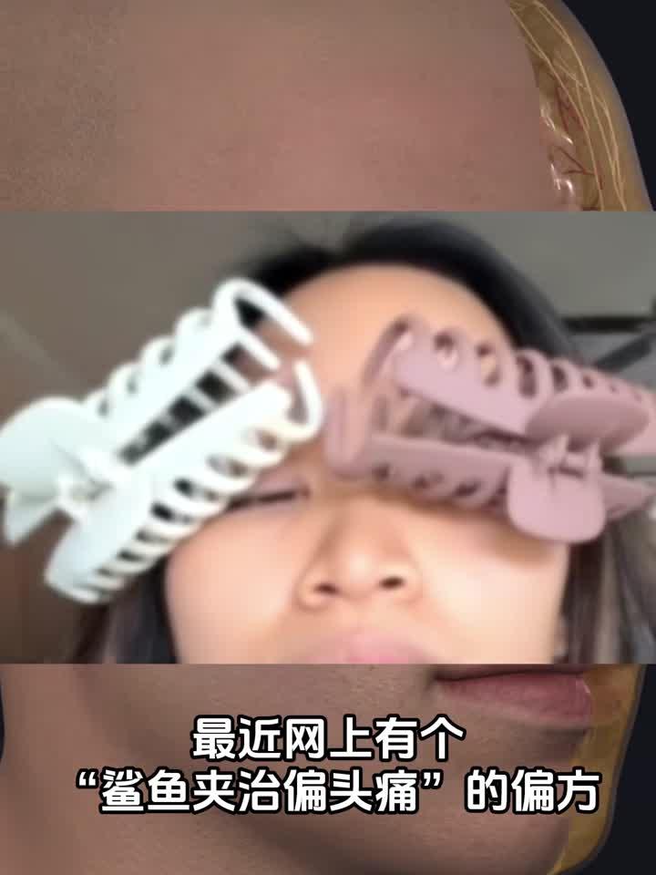 “鲨鱼夹”治偏头痛?到底是玄学还是科学?医生带你拆解真相!