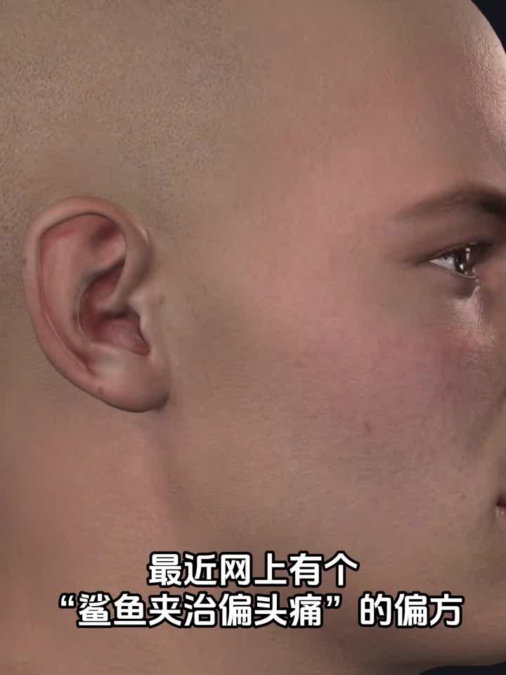 “鲨鱼夹”治偏头痛?到底是玄学还是科学?医生带你拆解真相!
