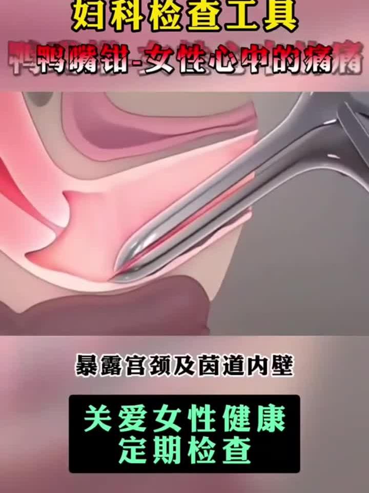 妇科检查工具