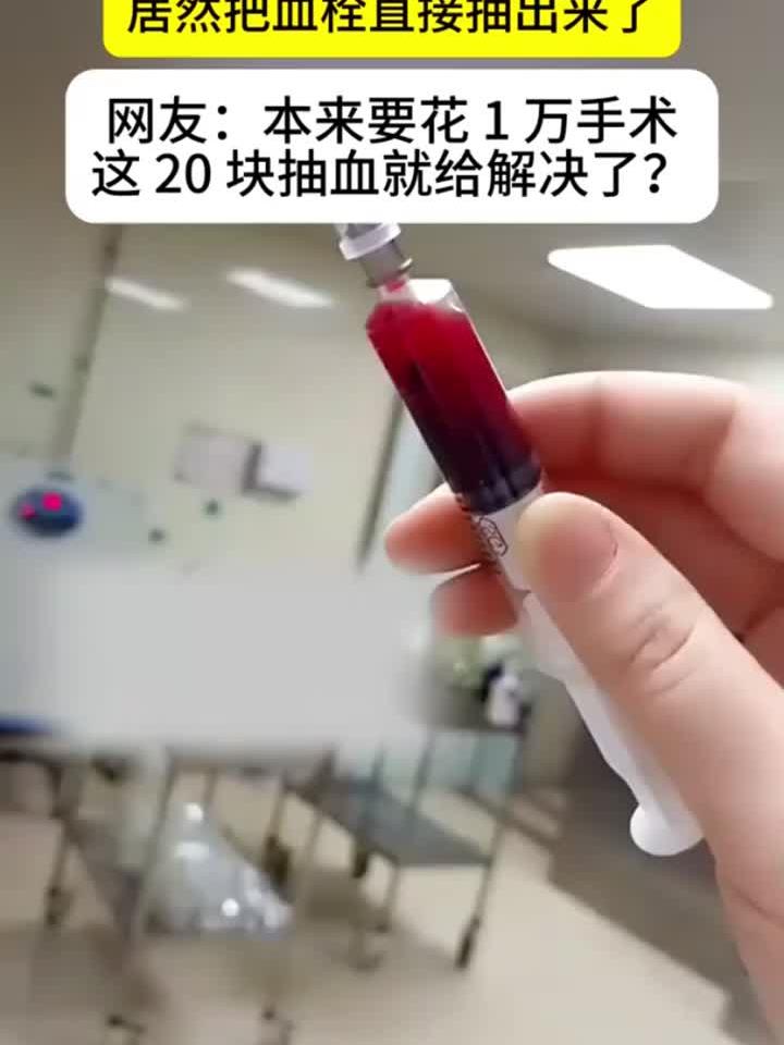 女护士抽血竟抽出患者血栓，网友：20元省下万元手术费