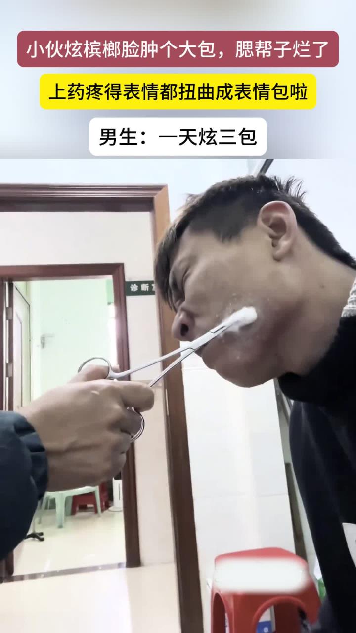 健康说:小伙吃槟榔脸上长了一个大包,腮帮子溃烂上药疼出表情包