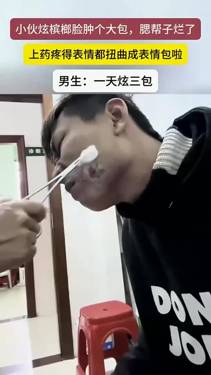 小伙吃槟榔脸上长了一个大包,腮帮子溃烂上药疼出表情包
