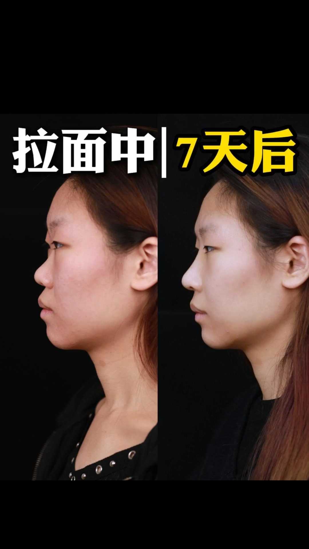 “鲶鱼系长相”·一张模特脸