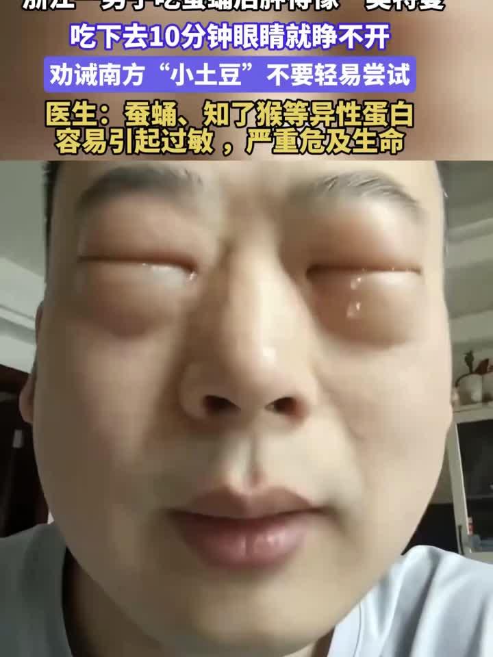 健康解析：浙江一男子吃蚕蛹后肿得像“奥特曼”！