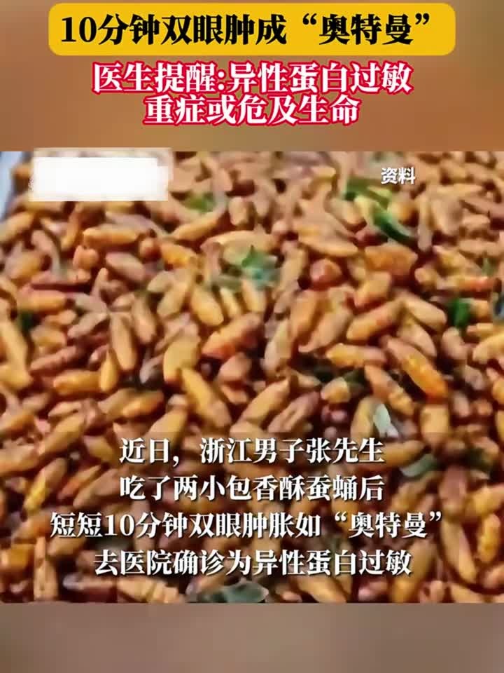 健康趣味说:男子吃蚕蛹过敏,10分钟双眼肿成“奥特曼”