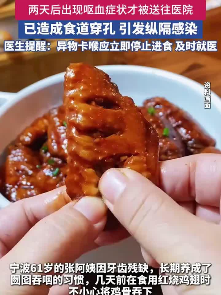 六旬老人吞鸡骨险丧命鸡骨头 卡喉咙怎么办