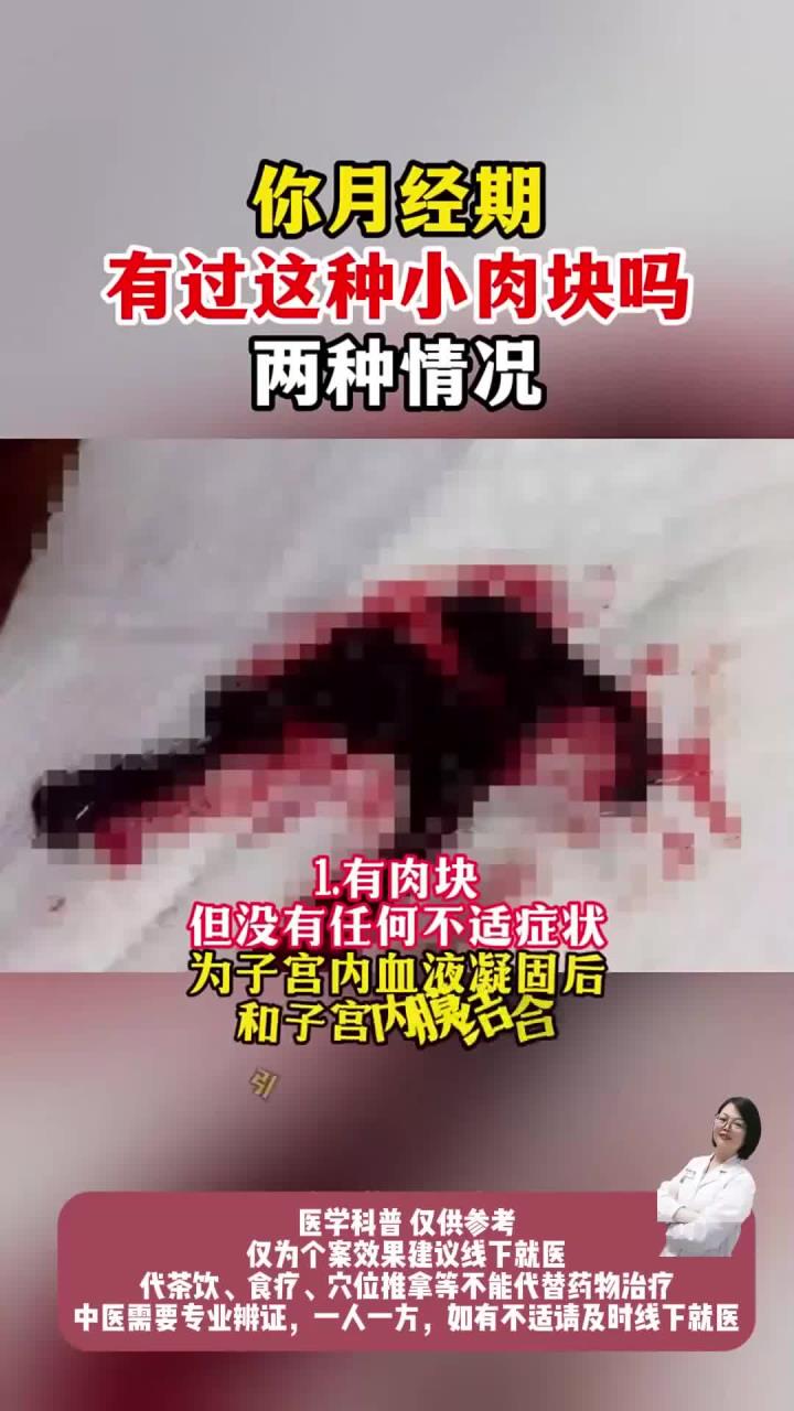 你月经期有过这种小肉块吗