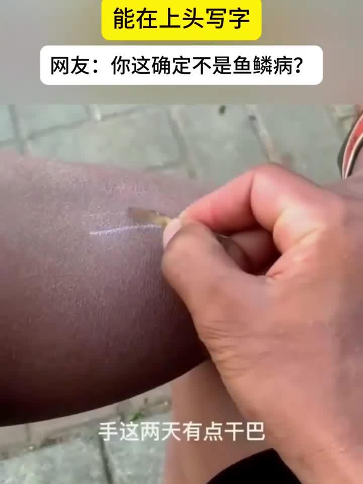 大家聊养生：男子的皮肤有点干巴，甚至能在上面写字