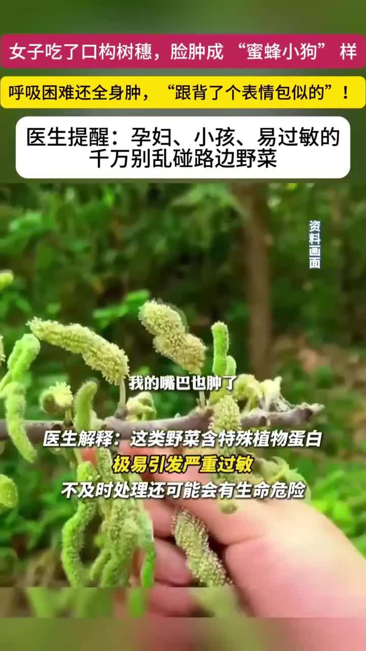 女子吃了口构树穗肿成“蜜蜂小狗”
