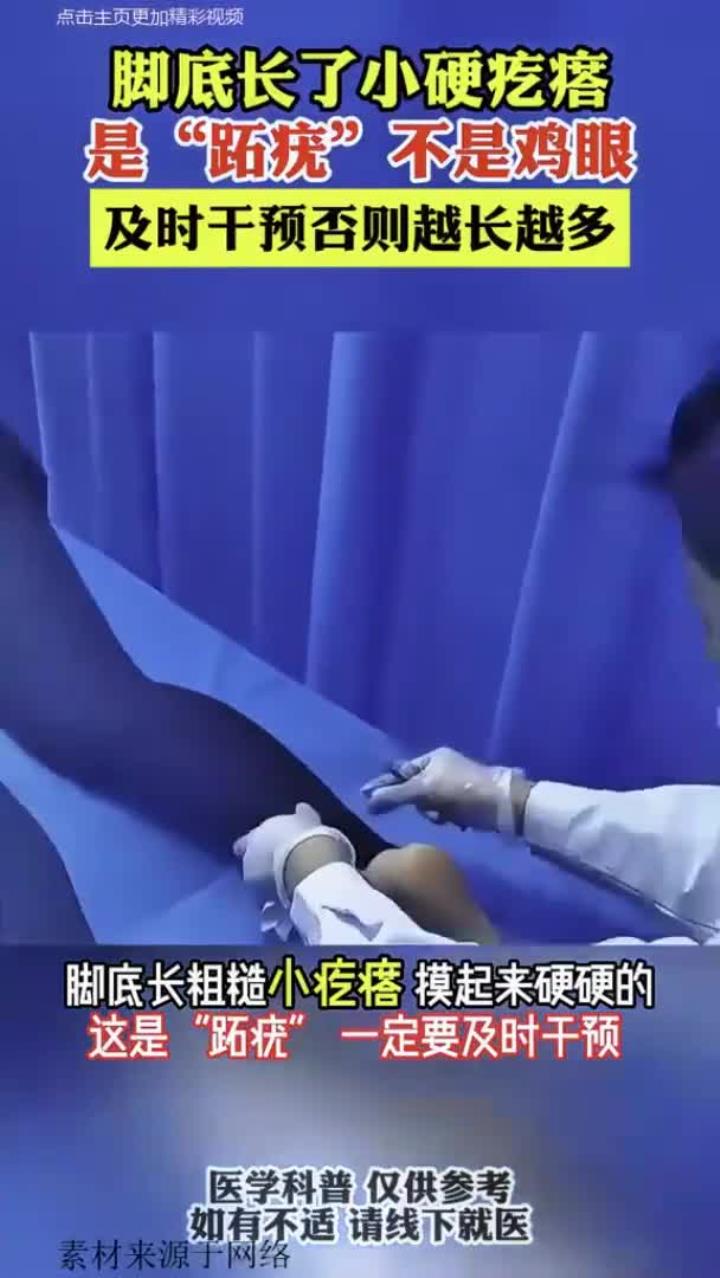 别把跖疣当鸡眼！拖延恐蔓延，速看正确应对指南